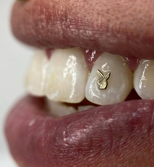 Gema dental Alicante