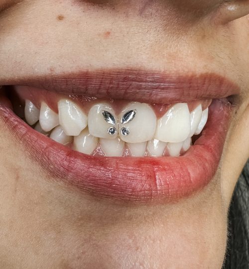 gemas dentales alicante (7)