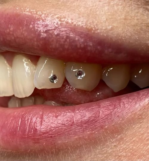 Gemas Dentales La Llama Tattoo
