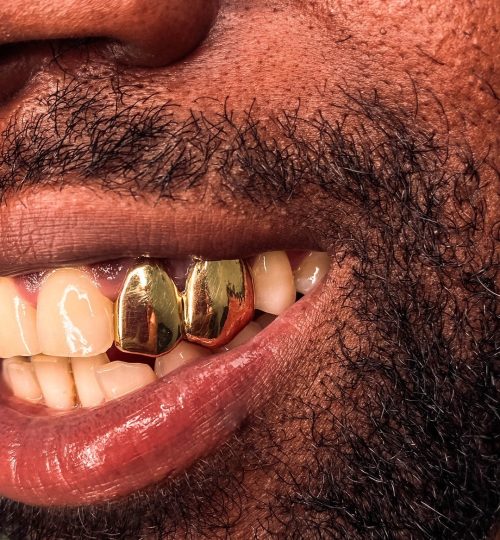 grills de oro sólido de 22 kilates ✨ para el incisivo lateral y colmillo de @hugobrownsugar by @